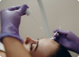 Chemical-Peels-vancouver