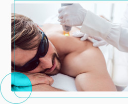 laser-hair-removal-treatment-near-me